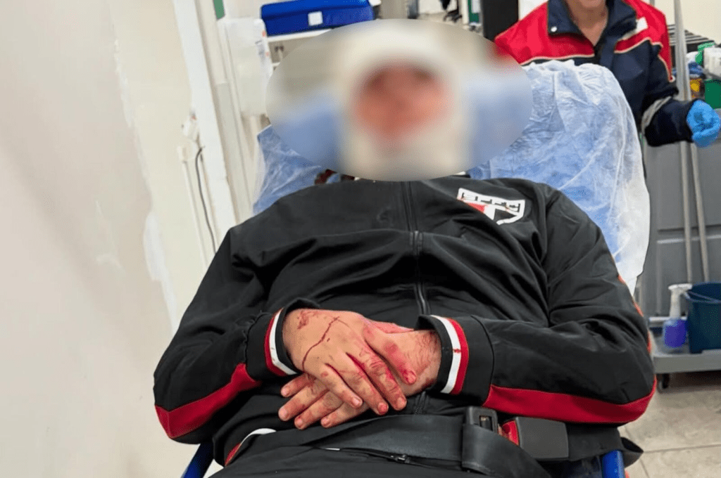 Pai e filho continuam internados após placa despencar sobre ambos no Estádio do&nbsp;Morumbi